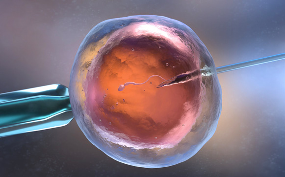 Fertilización in vitro (FIV)