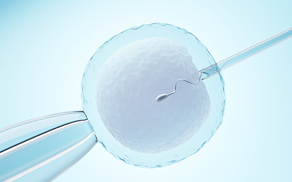 Inseminación artificial (intrauterina)